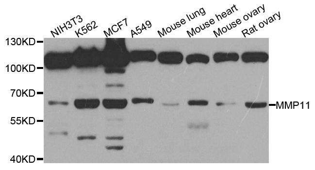 MMP11 Antibody - Western blot analysis of extracts of various cell lines.