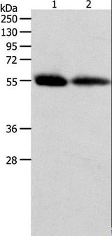 MMP11 Antibody - Western blot analysis of Human colon and ovarian cancer tissue, using MMP11 Polyclonal Antibody at dilution of 1:600.
