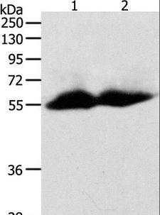 MMP11 Antibody - Western blot analysis of Human colon and ovarian cancer tissue, using MMP11 Polyclonal Antibody at dilution of 1:600.