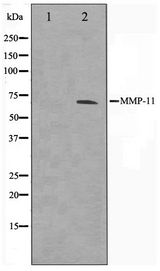 MMP11 Antibody - Western blot of A549 cell lysate using MMP11 Antibody