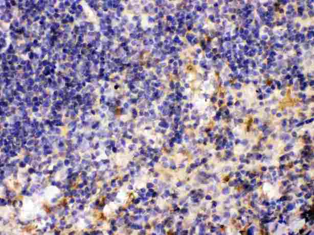 MMP11 Antibody - MMP11 was detected in paraffin-embedded sections of mouse spleen tissues using rabbit anti- MMP11 Antigen Affinity purified polyclonal antibody