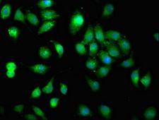 MMP11 Antibody - Immunofluorescent analysis of A549 cells at a dilution of 1:100 and Alexa Fluor 488-congugated AffiniPure Goat Anti-Rabbit IgG(H+L)
