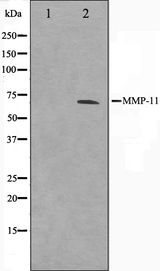 MMP11 Antibody - Western blot analysis on A549 cell lysates using MMP11 antibody. The lane on the left is treated with the antigen-specific peptide.