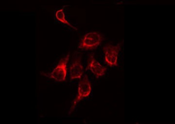 MMP11 Antibody - Staining A549 cells by IF/ICC. The samples were fixed with PFA and permeabilized in 0.1% Triton X-100, then blocked in 10% serum for 45 min at 25°C. The primary antibody was diluted at 1:200 and incubated with the sample for 1 hour at 37°C. An Alexa Fluor 594 conjugated goat anti-rabbit IgG (H+L) Ab, diluted at 1/600, was used as the secondary antibody.