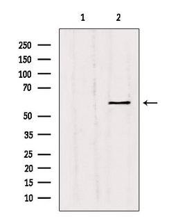 MMP11 Antibody - Western blot analysis of extracts of HepG2 cells using MMP11 antibody. Lane 1 was treated with the blocking peptide.