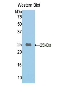 MMP12 Antibody - Western blot of recombinant MMP12 / MMP-12.  This image was taken for the unconjugated form of this product. Other forms have not been tested.