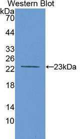 MMP12 Antibody - Western Blot; Sample: Recombinant protein.