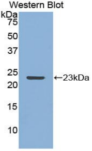 MMP12 Antibody - Western blot of recombinant MMP12.