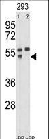 MMP12 Antibody - Western blot of anti-hMMP12-R406 antibody pre-incubated without(lane 1) and with(lane 2) blocking peptide in 293 cell line lysate. MMP12(arrow) was detected using the purified antibody;