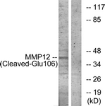 MMP12 Antibody - Western blot of extracts from NIH-3T3 cells, treated with etoposide 25 uM 1h, using MMP12 (Cleaved-Glu106) Antibody. The lane on the right is treated with the synthesized peptide.