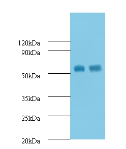 MMP12 Antibody - Western blot of Macrophage metalloelastase Antibody at 2 ug/ml.  This image was taken for the unconjugated form of this product. Other forms have not been tested.