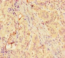 MMP12 Antibody - Immunohistochemistry of paraffin-embedded human adrenal gland tissue using MMP12 Antibody at dilution of 1:100