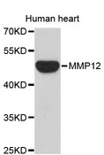 MMP12 Antibody - Western blot analysis of extracts of human heart, using MMP12 antibody. The secondary antibody used was an HRP Goat Anti-Rabbit IgG (H+L) at 1:10000 dilution. Lysates were loaded 25ug per lane and 3% nonfat dry milk in TBST was used for blocking.