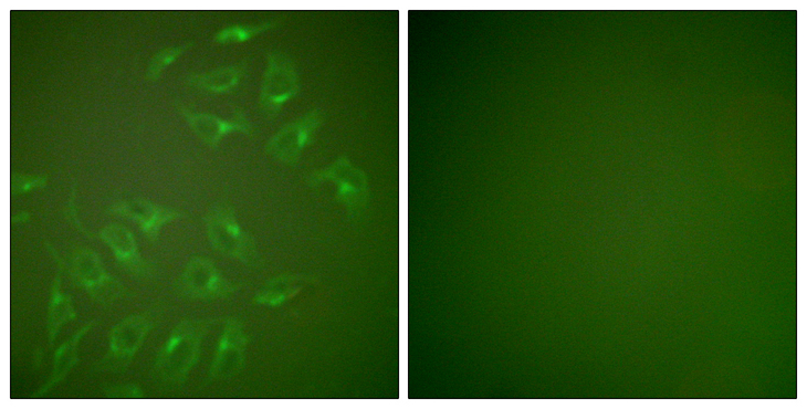MMP13 Antibody - Immunofluorescence analysis of HepG2 cells, using MMP-13 Antibody. The picture on the right is blocked with the synthesized peptide.