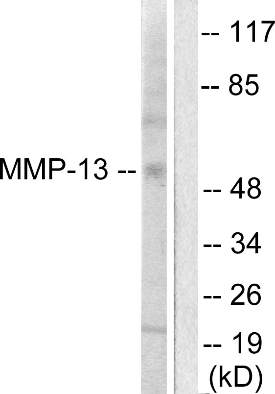 MMP13 Antibody - Western blot analysis of lysates from LOVO cells, using MMP-13 Antibody. The lane on the right is blocked with the synthesized peptide.