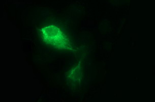 MMP13 Antibody - Anti-MMP13 mouse monoclonal antibody immunofluorescent staining of COS7 cells transiently transfected by pCMV6-ENTRY MMP13.