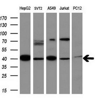MMP13 Antibody - Western blot of extracts (10ug) from 5 different cell lines by using anti-MMP13 monoclonal antibody at 1:200 dilution.