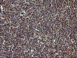 MMP13 Antibody - IHC of paraffin-embedded Human lymph node tissue using anti-MMP13 mouse monoclonal antibody. (Heat-induced epitope retrieval by 10mM citric buffer, pH6.0, 120°C for 3min).