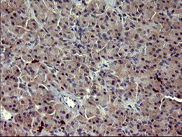 MMP13 Antibody - IHC of paraffin-embedded Human pancreas tissue using anti-MMP13 mouse monoclonal antibody. (Heat-induced epitope retrieval by 10mM citric buffer, pH6.0, 120°C for 3min).