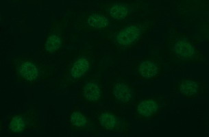 MMP13 Antibody - Immunofluorescent staining of HeLa cells using anti-MMP13 mouse monoclonal antibody.