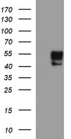 MMP13 Antibody - HEK293T cells were transfected with the pCMV6-ENTRY control (Left lane) or pCMV6-ENTRY MMP13 (Right lane) cDNA for 48 hrs and lysed. Equivalent amounts of cell lysates (5 ug per lane) were separated by SDS-PAGE and immunoblotted with anti-MMP13.
