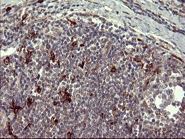 MMP13 Antibody - IHC of paraffin-embedded Human lymph node tissue using anti-MMP13 mouse monoclonal antibody. (Heat-induced epitope retrieval by 10mM citric buffer, pH6.0, 120°C for 3min).
