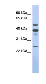 MMP13 Antibody - MMP13 antibody Western blot of Placenta lysate. This image was taken for the unconjugated form of this product. Other forms have not been tested.