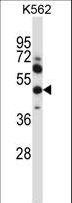 MMP13 Antibody - MMP13 Antibody western blot of K562 cell line lysates (35 ug/lane). The MMP13 antibody detected the MMP13 protein (arrow).