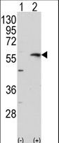 MMP13 Antibody - Western blot of MMP13(arrow) using rabbit polyclonal MMP13 Antibody. 293 cell lysates (2 ug/lane) either nontransfected (Lane 1) or transiently transfected with the MMP13 gene (Lane 2) (Origene Technologies).