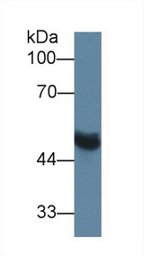 MMP13 Antibody - Western Blot; Sample: Rat Serum; Primary Ab: 1µg/ml Rabbit Anti-Rat MMP13 Antibody Second Ab: 0.2µg/mL HRP-Linked Caprine Anti-Rabbit IgG Polyclonal Antibody