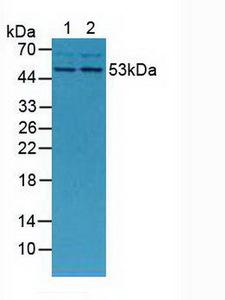 MMP13 Antibody - Western Blot; Sample: Lane1: Mouse Placenta Tissue; Lane2: Mouse Breast Tissue.