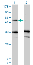 MMP13 Antibody - Western Blot analysis of MMP13 expression in transfected 293T cell line by MMP13 monoclonal antibody (M07), clone 3B11.Lane 1: MMP13 transfected lysate(53.8 KDa).Lane 2: Non-transfected lysate.