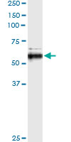 MMP13 Antibody - Immunoprecipitation of MMP13 transfected lysate using anti-MMP13 monoclonal antibody and Protein A Magnetic Bead, and immunoblotted with MMP13 rabbit polyclonal antibody.
