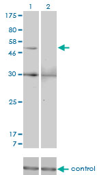 MMP13 Antibody - Western blot analysis of MMP13 over-expressed 293 cell line, cotransfected with MMP13 Validated Chimera RNAi (Lane 2) or non-transfected control (Lane 1). Blot probed with MMP13 monoclonal antibody (M07), clone 3B11 . GAPDH ( 36.1 kDa ) used as specificity and loading control.
