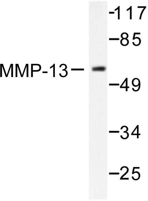 MMP13 Antibody - Western blot of MMP-13 (L22) pAb in extracts from LOVO cells.