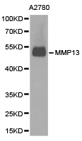 MMP13 Antibody - Western blot of extracts of A2780 cell lines, using MMP13 antibody.