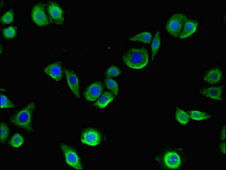 MMP13 Antibody - Immunofluorescent analysis of PC-3 cells using MMP13 Antibody at dilution of 1:100 and Alexa Fluor 488-congugated AffiniPure Goat Anti-Rabbit IgG(H+L)