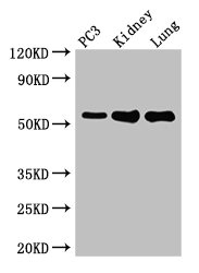 MMP13 Antibody - Western Blot Positive WB detected in: PC-3 whole cell lysate, Mouse kidney tissue, Mouse lung tissue All lanes: MMP13 antibody at 2µg/ml Secondary Goat polyclonal to rabbit IgG at 1/50000 dilution Predicted band size: 54 kDa Observed band size: 54 kDa