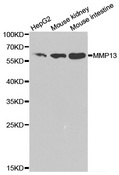 MMP13 Antibody - Western blot analysis of extracts of various cell lines, using MMP13 antibody at 1:1000 dilution. The secondary antibody used was an HRP Goat Anti-Rabbit IgG (H+L) at 1:10000 dilution. Lysates were loaded 25ug per lane and 3% nonfat dry milk in TBST was used for blocking.