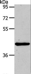 MMP13 Antibody - Western blot analysis of HeLa cell, using MMP13 Polyclonal Antibody at dilution of 1:500.
