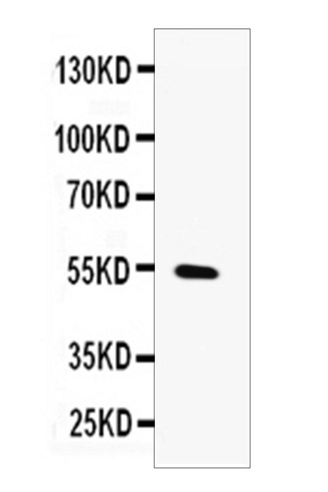 MMP13 Antibody - Western blot analysis of MMP13 using anti-MMP13 antibody. Electrophoresis was performed on a 5-20% SDS-PAGE gel at 70V (Stacking gel) / 90V (Resolving gel) for 2-3 hours. The sample well of each lane was loaded with 50ug of sample under reducing conditions. Lane 1: HELA whole cell lysates. After Electrophoresis, proteins were transferred to a Nitrocellulose membrane at 150mA for 50-90 minutes. Blocked the membrane with 5% Non-fat Milk/ TBS for 1.5 hour at RT. The membrane was incubated with rabbit anti-MMP13 antigen affinity purified polyclonal antibody at 0.5 µg/mL overnight at 4°C, then washed with TBS-0.1% Tween 3 times with 5 minutes each and probed with a goat anti-rabbit IgG-HRP secondary antibody at a dilution of 1:10000 for 1.5 hour at RT. The signal is developed using an Enhanced Chemiluminescent detection (ECL) kit with Tanon 5200 system. A specific band was detected for MMP13 at approximately 54KD. The expected band size for MMP13 is at 54KD.