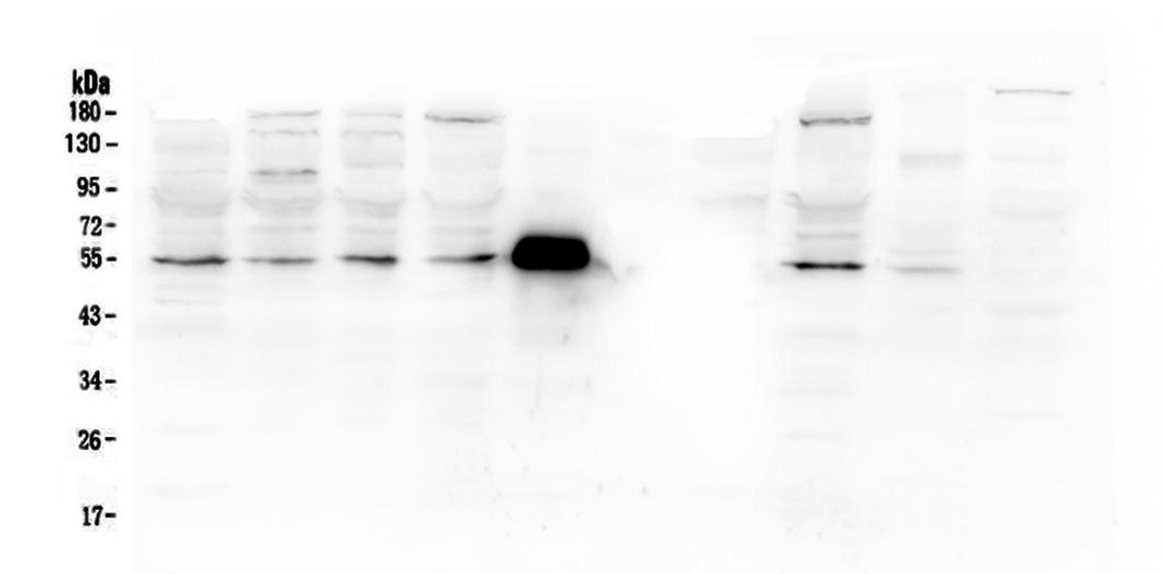 MMP13 Antibody - Western blot analysis of MMP13 using anti-MMP13 antibody. Electrophoresis was performed on a 5-20% SDS-PAGE gel at 70V (Stacking gel) / 90V (Resolving gel) for 2-3 hours. The sample well of each lane was loaded with 50ug of sample under reducing conditions. Lane 1: human PC-3 whole cell lysates, Lane 2: human U20S whole cell lysates, Lane 3: human A549 whole cell lysates, Lane 4: human HEK293 whole cell lysates. Lane 5: Rabbit IgG(55KD), Lane 6: Marker 1113 Lane 7: human MDA-MB-453 whole cell lysates, Lane 8: monkey COS-7 whole cell lysates, Lane 9: rat lung tissue lysates, Lane 10: mouse lung tissue lysates, After Electrophoresis, proteins were transferred to a Nitrocellulose membrane at 150mA for 50-90 minutes. Blocked the membrane with 5% Non-fat Milk/ TBS for 1.5 hour at RT. The membrane was incubated with rabbit anti-MMP13 antigen affinity purified polyclonal antibody at 0.5 µg/mL overnight at 4°C, then washed with TBS-0.1% Tween 3 times with 5 minutes each and probed with a goat anti-rabbit IgG-HRP secondary antibody at a dilution of 1:10000 for 1.5 hour at RT. The signal is developed using an Enhanced Chemiluminescent detection (ECL) kit with Tanon 5200 system. A specific band was detected for MMP13 at approximately 54KD. The expected band size for MMP13 is at 54KD.