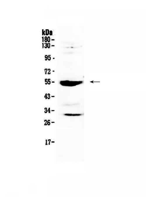MMP13 Antibody - Western blot - Anti-MMP13 Picoband antibody