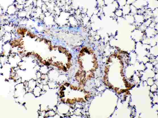 MMP13 Antibody - Immunohistochemistry - Anti-MMP13 Picoband antibody