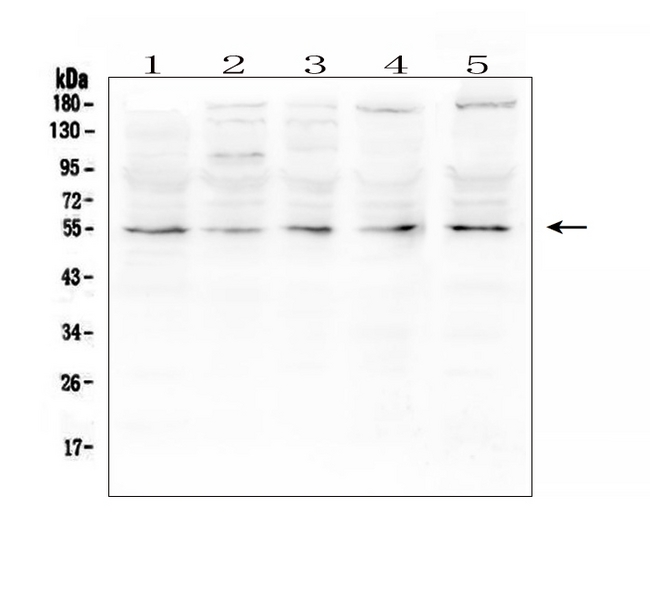 MMP13 Antibody - Western blot analysis of MMP13 using anti-MMP13 antibody. Electrophoresis was performed on a 5-20% SDS-PAGE gel at 70V (Stacking gel) / 90V (Resolving gel) for 2-3 hours. The sample well of each lane was loaded with 50ug of sample under reducing conditions. Lane 1: human PC-3 whole cell lysates, Lane 2: human U2OS whole cell lysates, Lane 3: human A549 whole cell lysates, Lane 4: human HEK293 whole cell lysates, Lane 5: monkey COS-7 whole cell lysates. After Electrophoresis, proteins were transferred to a Nitrocellulose membrane at 150mA for 50-90 minutes. Blocked the membrane with 5% Non-fat Milk/ TBS for 1.5 hour at RT. The membrane was incubated with rabbit anti-MMP13 antigen affinity purified polyclonal antibody at 0.5 µg/mL overnight at 4°C, then washed with TBS-0.1% Tween 3 times with 5 minutes each and probed with a goat anti-rabbit IgG-HRP secondary antibody at a dilution of 1:10000 for 1.5 hour at RT. The signal is developed using an Enhanced Chemiluminescent detection (ECL) kit with Tanon 5200 system. A specific band was detected for MMP13 at approximately 54KD. The expected band size for MMP13 is at 54KD.