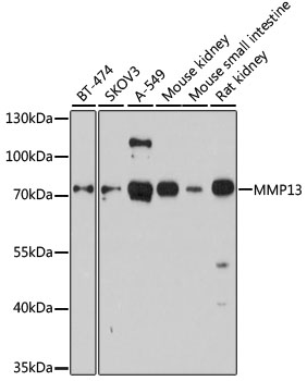 MMP13 Antibody - Western blot analysis of extracts of various cell lines, using at 1:1000 dilution. The secondary antibody used was an HRP Goat Anti-Rabbit IgG (H+L) at 1:10000 dilution. Lysates were loaded 25ug per lane and 3% nonfat dry milk in TBST was used for blocking. An ECL Kit was used for detection and the exposure time was 90s.