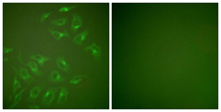 MMP13 Antibody - Peptide - + Immunofluorescence analysis of HepG2 cells, using MMP-13 antibody.