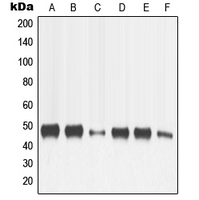 MMP13 Antibody - Western blot analysis of MMP13 expression in HeLa (A); SP2/0 (B); H9C2 (C); MCF7 (D); HT1080 (E); SCC4 (F) whole cell lysates.