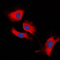 MMP13 Antibody - Immunofluorescent analysis of MMP13 staining in HeLa cells. Formalin-fixed cells were permeabilized with 0.1% Triton X-100 in TBS for 5-10 minutes and blocked with 3% BSA-PBS for 30 minutes at room temperature. Cells were probed with the primary antibody in 3% BSA-PBS and incubated overnight at 4 C in a humidified chamber. Cells were washed with PBST and incubated with a DyLight 594-conjugated secondary antibody (red) in PBS at room temperature in the dark. DAPI was used to stain the cell nuclei (blue).