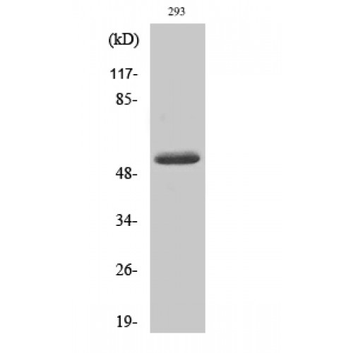 MMP14 Antibody - Western blot of Cleaved-MMP-14 (Y112) antibody